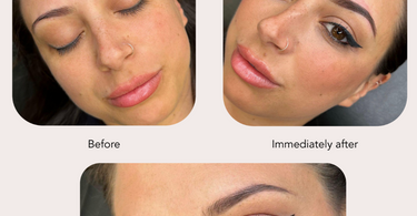 Tina Davies Fade ~ Geheelde resultaten / Healed Results